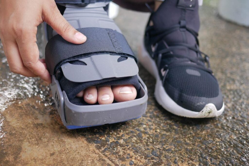 Why Small Employers Underestimate the Legal Side of Workplace Injuries Employee wearing a medical boot after a workplace injury